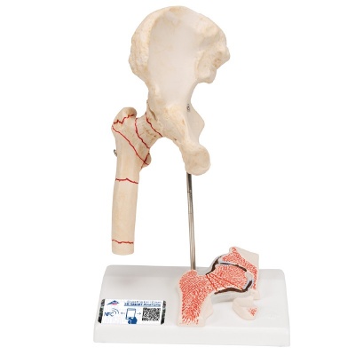 3B Scientific Mini Hip Joint Model - Half-Size Anatomy Model With Cross Section